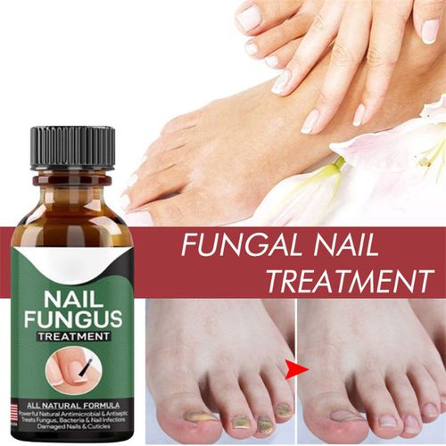 Nail Fungus Serum